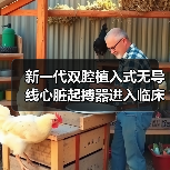 新一代双腔植入式无导线心脏起搏器进入临床 造福缓慢性心律失常患者 来源:互联网 2025-08-19(图2) 新一代双腔植入式无导线心脏起搏器进入临床 造福缓慢性心律失常患者 来源:互联网 2025-08-19(图2)