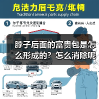 脖子后面的富贵包是怎么形成的?怎么消除呢?成都新华医院医疗美容中心为您解答(图4) 脖子后面的富贵包是怎么形成的?怎么消除呢?成都新华医院医疗美容中心为您解答(图4)