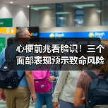 心梗前兆看脸识!三个面部表现预示致命风险(图4) 心梗前兆看脸识!三个面部表现预示致命风险(图4)