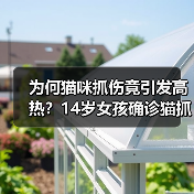 为何猫咪抓伤竟引发高热？14岁女孩确诊猫抓病