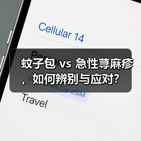 蚊子包 vs 急性荨麻疹,如何辨别与应对?(图2) 蚊子包 vs 急性荨麻疹,如何辨别与应对?(图2)