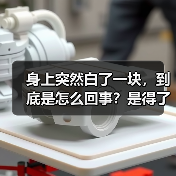 身上突然白了一块,到底是怎么回事?是得了白癜风吗? 来源:互联网 2026-04-22(图2) 身上突然白了一块,到底是怎么回事?是得了白癜风吗? 来源:互联网 2026-04-22(图2)