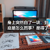身上突然白了一块,到底是怎么回事?是得了白癜风吗? 来源:互联网 2026-04-22(图4) 身上突然白了一块,到底是怎么回事?是得了白癜风吗? 来源:互联网 2026-04-22(图4)