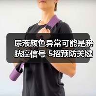 尿液颜色异常可能是膀胱癌信号 5招预防关键（图4）