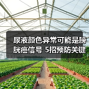 尿液颜色异常可能是膀胱癌信号 5招预防关键（图3）