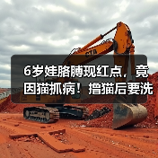 6岁娃胳膊现红点，竟因猫抓病！撸猫后要洗手（图3）