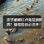 孩子胳膊红点竟是猫抓病?撸猫后务必洗手!(图2) 孩子胳膊红点竟是猫抓病?撸猫后务必洗手!(图2)