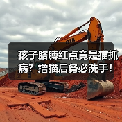 孩子胳膊红点竟是猫抓病?撸猫后务必洗手!(图3) 孩子胳膊红点竟是猫抓病?撸猫后务必洗手!(图3)