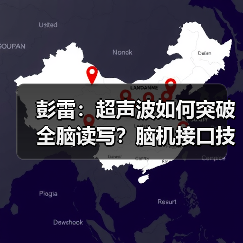 彭雷:超声波如何突破全脑读写?脑机接口技术前瞻(图4) 彭雷:超声波如何突破全脑读写?脑机接口技术前瞻(图4)