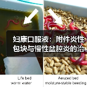 妇康口服液:附件炎性包块与慢性盆腔炎的治疗方案(图1) 妇康口服液:附件炎性包块与慢性盆腔炎的治疗方案(图1)